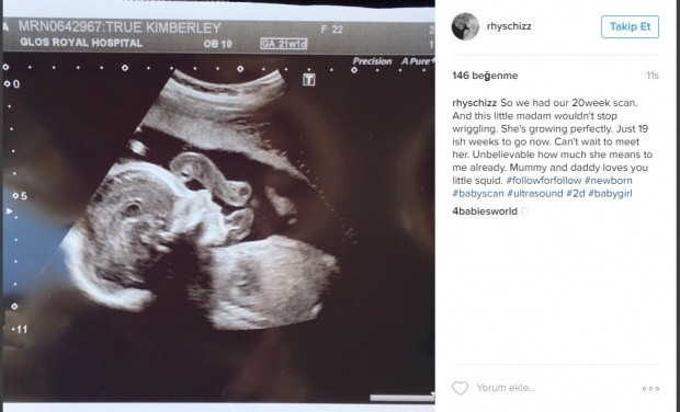 Bebeklerinin ultrason görüntülerini Instagramdan paylaşan anne adayları