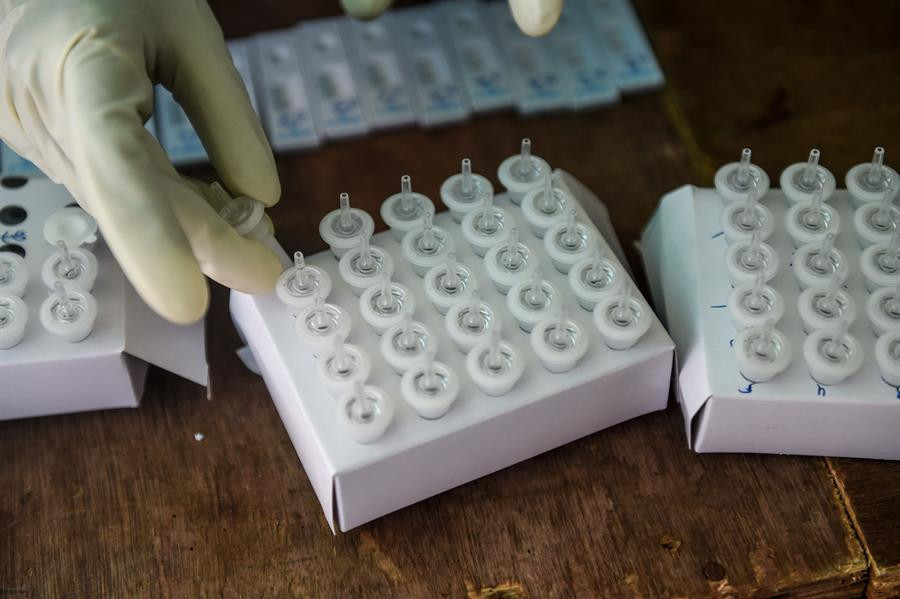 Son dakika haberi: Rusya dünyanın ilk koronavirüs aşısına onay veriyor Son dakika haberi: Rusya dünyanın ilk koronavirüs aşısına onay veriyor