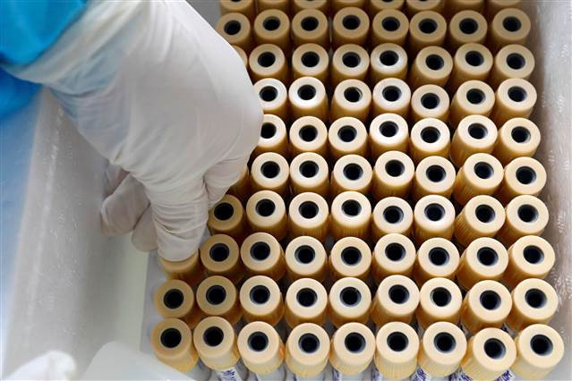 daha seyrek görülen semptomlar: