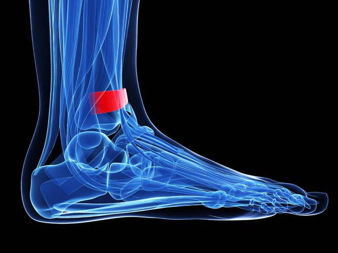 Kemik çıkıntısı basit bir ameliyatla törpülenir