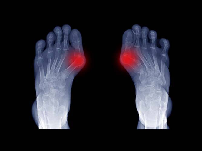 Uzman yardımı alınmalı