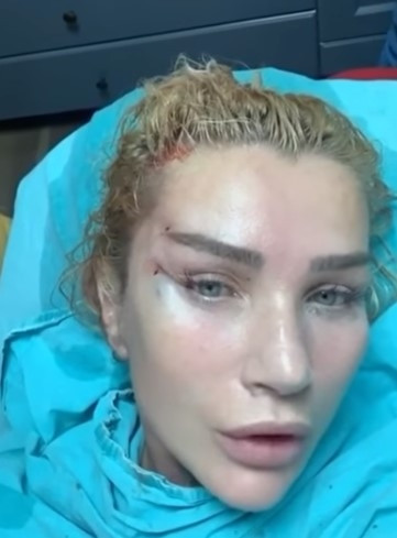 Damla Ersubaşı son halini paylaştı, takipçilerinden yorum yağdı