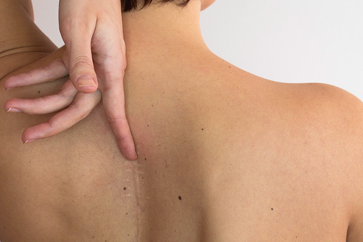 Her 10 çocuktan 1inde görülüyor... Erken teşhisi hayati önem taşıyor Her 10 çocuktan 1inde görülüyor... Erken teşhisi hayati önem taşıyor