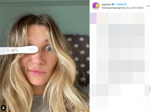 Bebek patlaması Onlara da ikinci çocuk geliyor