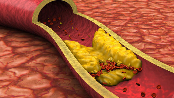 Diyabete bağlı gelişen hastalıklar Diyabete bağlı gelişen hastalıklar