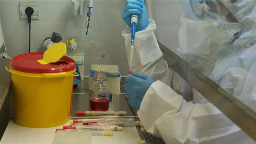 E NABIZ CORONA VİRÜS TEST SONUCU NASIL SORGULANIR E NABIZ CORONA VİRÜS TEST SONUCU NASIL SORGULANIR
