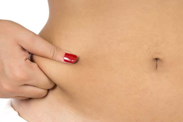 Doğum Sonrası Hangi Estetik Operasyonlar Yapılır