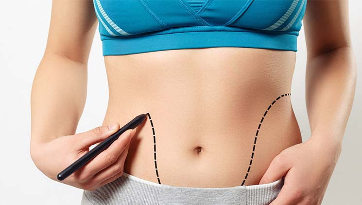 Doğum Sonrası Hangi Estetik Operasyonlar Yapılır