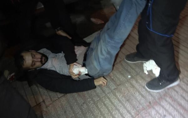Son dakika... DHA muhabirine çirkin saldırı; kısıtlamayı ihlal eden boksör, gazetecinin burnunu kırdı