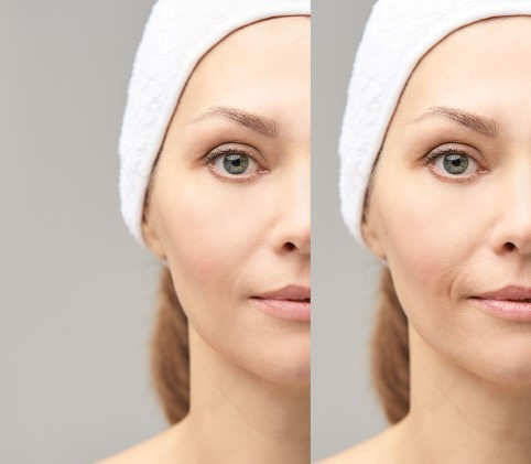 Göz Altı Torbaları Kimlerde Daha Çok Oluşur