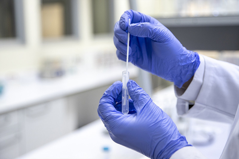 Türk bilim insanlarından koronavirüs teşhisini 10 saniyeye düşüren sistem