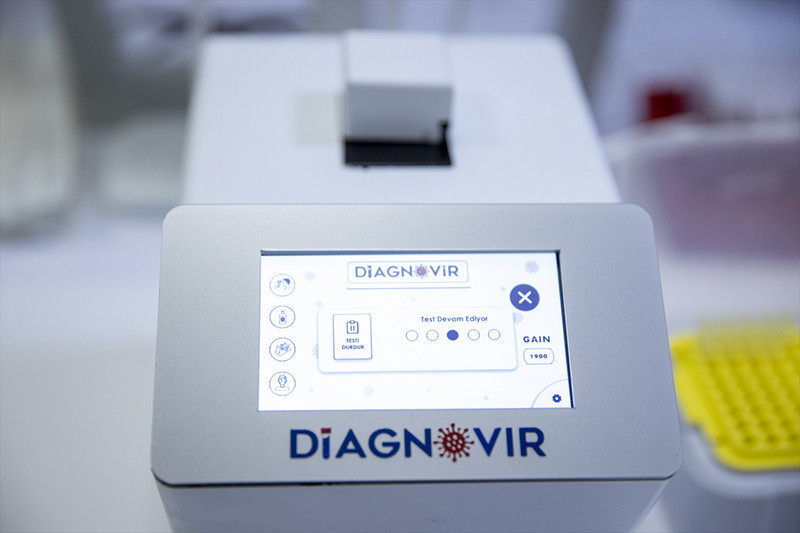 Türk bilim insanlarından koronavirüs teşhisini 10 saniyeye düşüren sistem