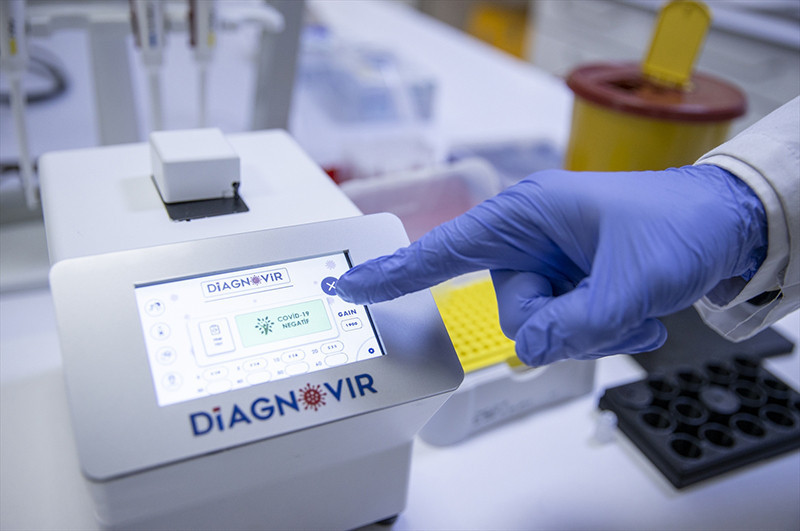 Türk bilim insanlarından koronavirüs teşhisini 10 saniyeye düşüren sistem