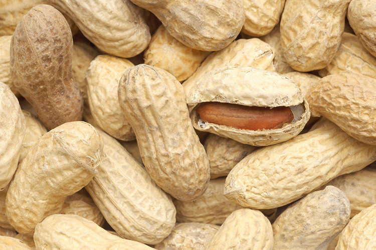 Her 10 kişiden 1inde görülebiliyor... Böbrek taşına karşı bunlara dikkat Her 10 kişiden 1inde görülebiliyor... Böbrek taşına karşı bunlara dikkat