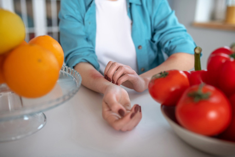Besin alerjisi belirtileri nelerdir, neden olur Besin alerjisine karşı bu yiyeceklere dikkat