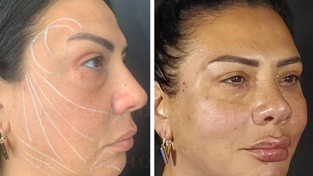 Damla Ersubaşı son halini paylaştı, takipçilerinden yorum yağdı