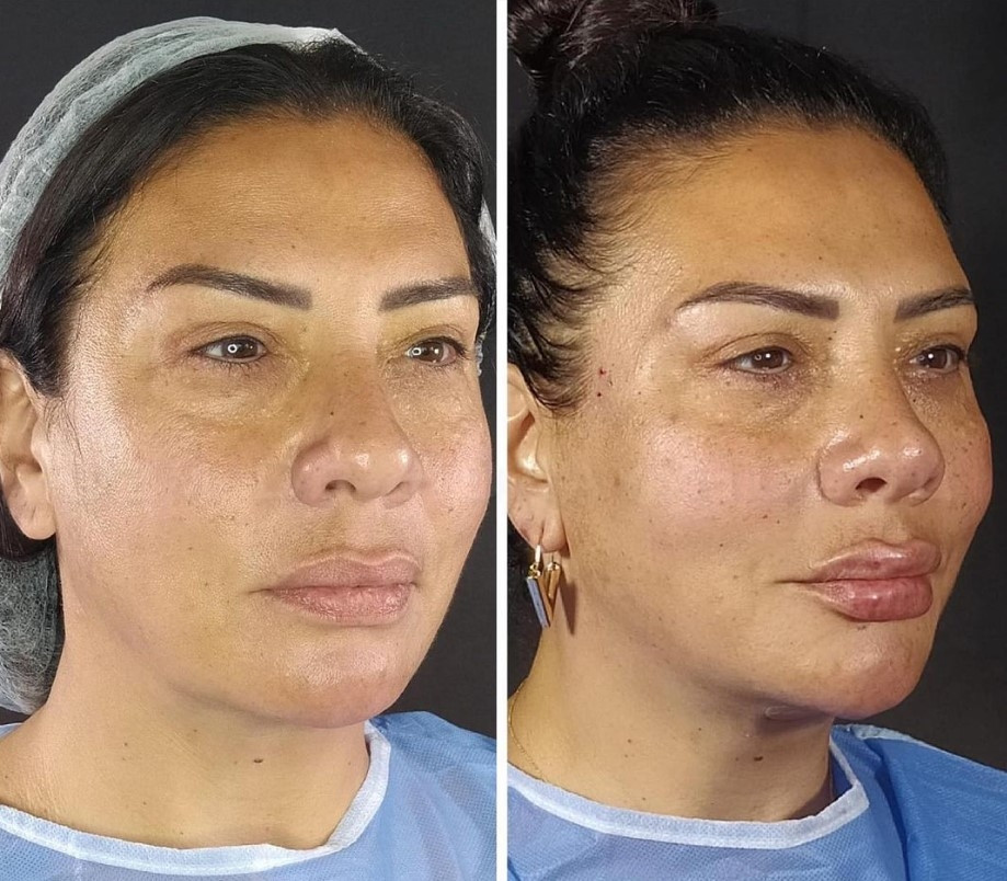 Damla Ersubaşı son halini paylaştı, takipçilerinden yorum yağdı