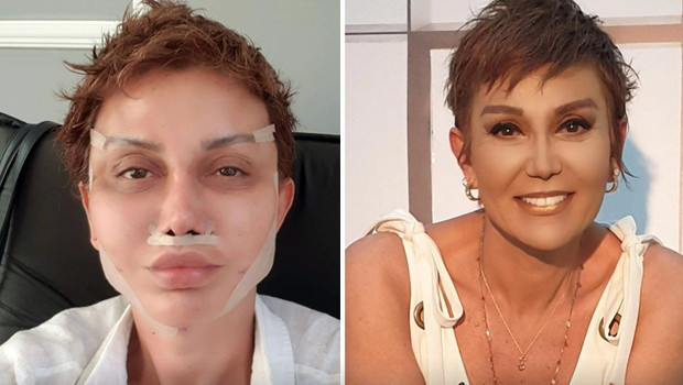 Damla Ersubaşı son halini paylaştı, takipçilerinden yorum yağdı
