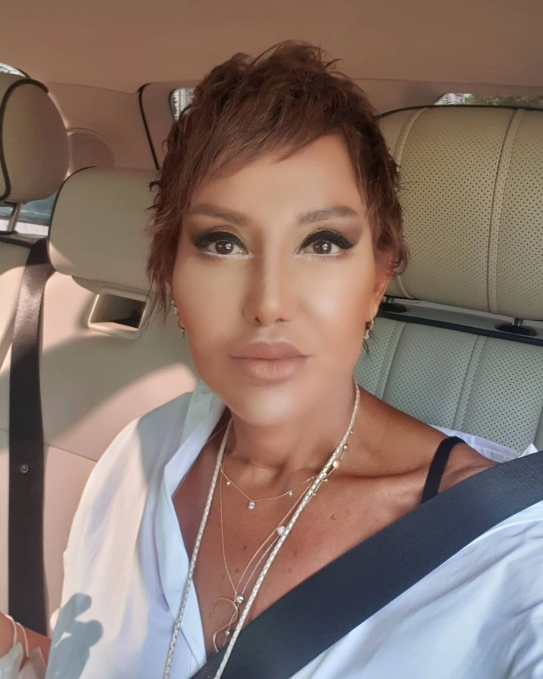 Deniz Sekiden estetik açıklaması: Hiçbir şey yaptırmadım