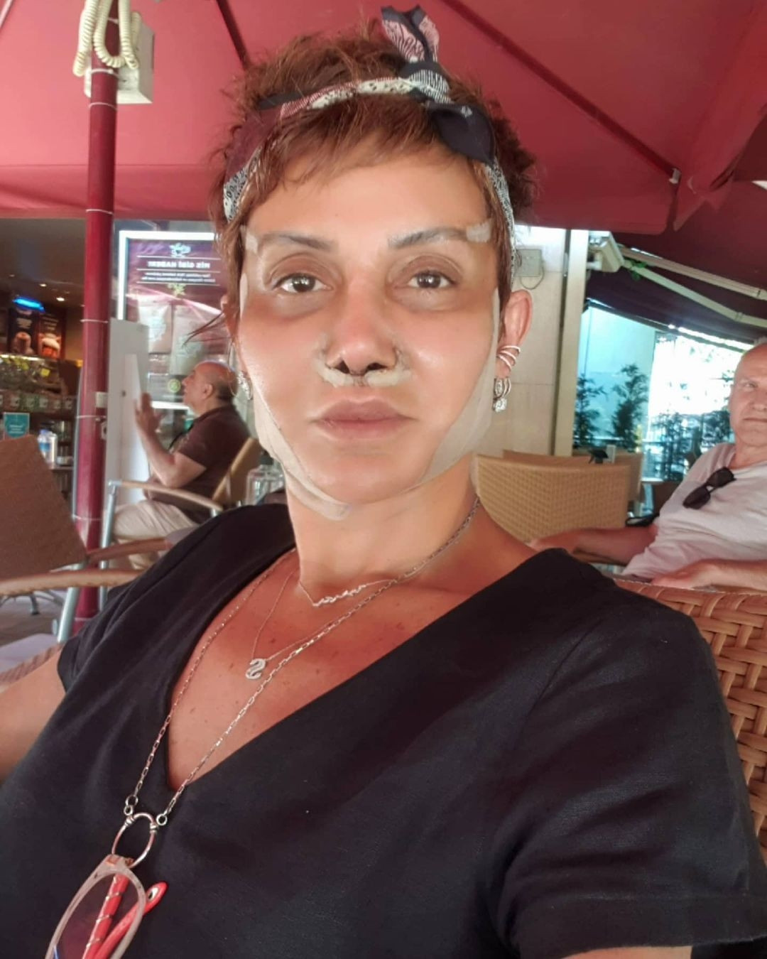 Deniz Sekiden estetik açıklaması: Hiçbir şey yaptırmadım