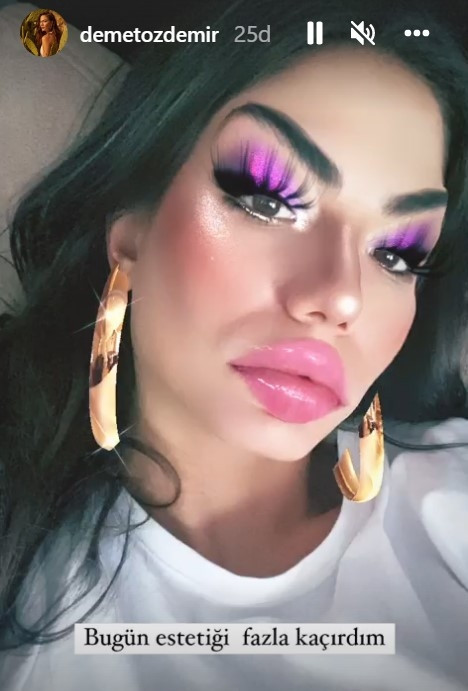 Demet Özdemirden iddialara yanıt: Bugün estetiği fazla kaçırdım