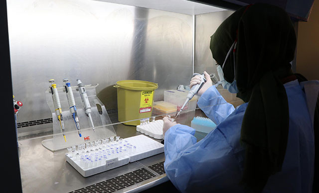 Omicron varyantı koronavirüs test (PCR) sonucunda çıkıyor mu Kovid-19 test sonucu kaç günde, saatte çıkar