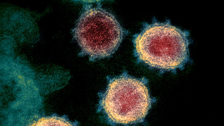 2- YİNE ÖLÜMCÜL BİR VİRÜS BU KEZ ADRES SİBİRYA 2- YİNE ÖLÜMCÜL BİR VİRÜS BU KEZ ADRES SİBİRYA