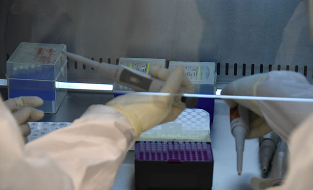 PCR testi özel hastanelerde ücretli mi PCR testi nerede yapılır İşte detaylar PCR testi özel hastanelerde ücretli mi PCR testi nerede yapılır İşte detaylar