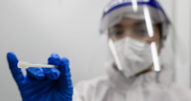Covid test sonucu ne zaman çıkar İşte PCR test sonuçları hakkında bilgiler