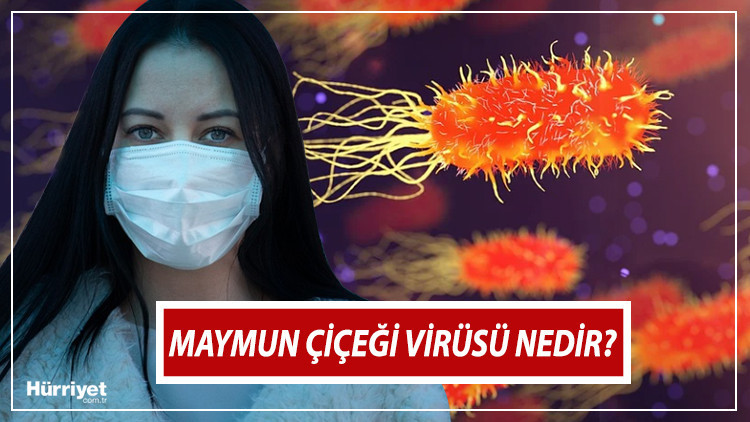 MAYMUN ÇİÇEĞİ VİRÜSÜ belirtileri nelerdir, nedir Maymun çiçeği(Monkeypox) bulaşıcı mı İşte tedavi hakkında bilgiler