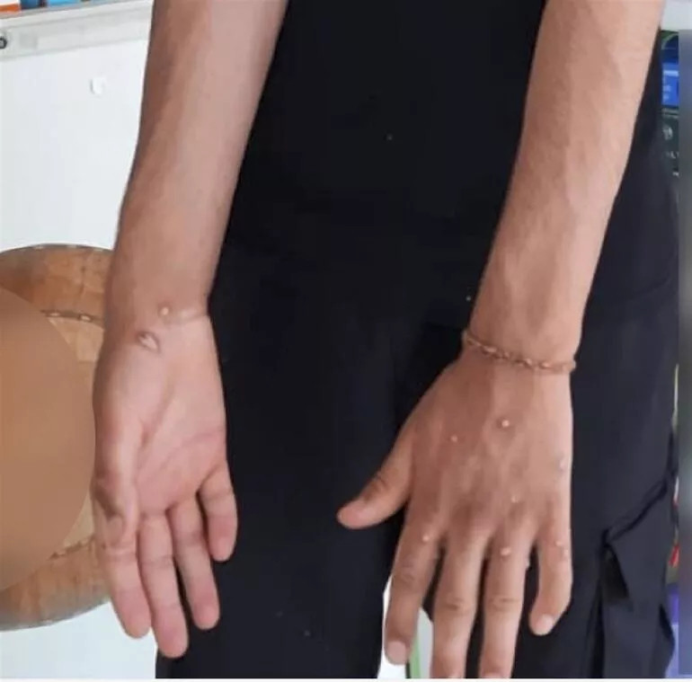 MAYMUN ÇİÇEĞİNE ÇOK BENZİYORDU