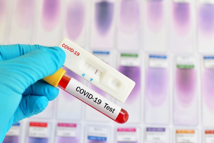 Covid test sonucu ne zaman çıkar Covid test sonucu ne zaman çıkar