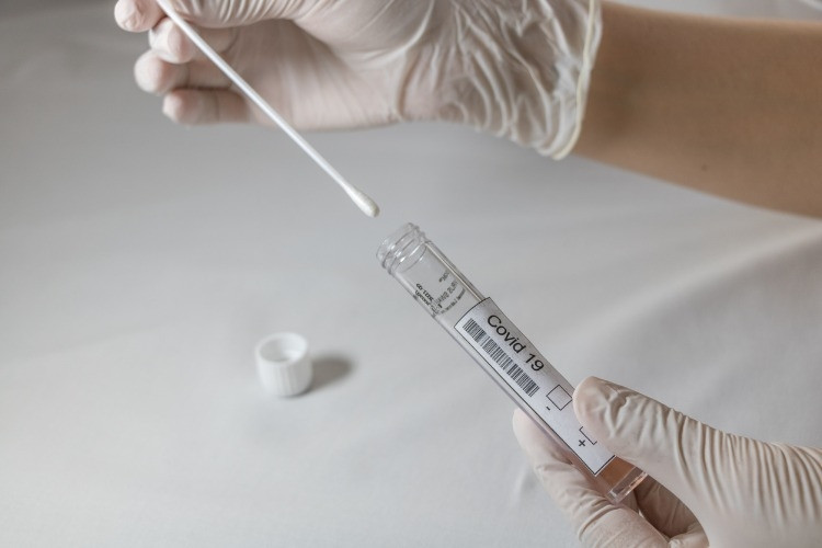 PCR test sonucu nasıl öğrenilir PCR test sonucu nasıl öğrenilir