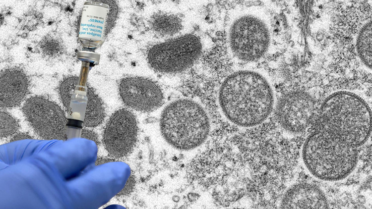 MAYMUN ÇİÇEĞİ VİRÜSÜ NEDİR