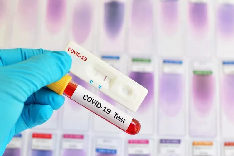 PCR TEST SONUCU NASIL ÖĞRENİLİR