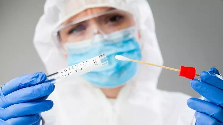 PCR TEST SONUCU NASIL ÖĞRENİLİR