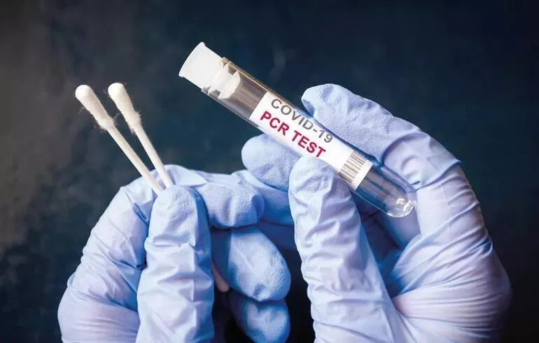 PCR TEST SONUCU NASIL ÖĞRENİLİR PCR TEST SONUCU NASIL ÖĞRENİLİR