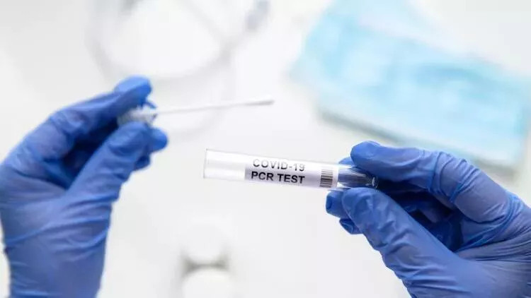 KORONAVİRÜS TEST SONUCU KAÇ GÜNDE ÇIKAR KORONAVİRÜS TEST SONUCU KAÇ GÜNDE ÇIKAR