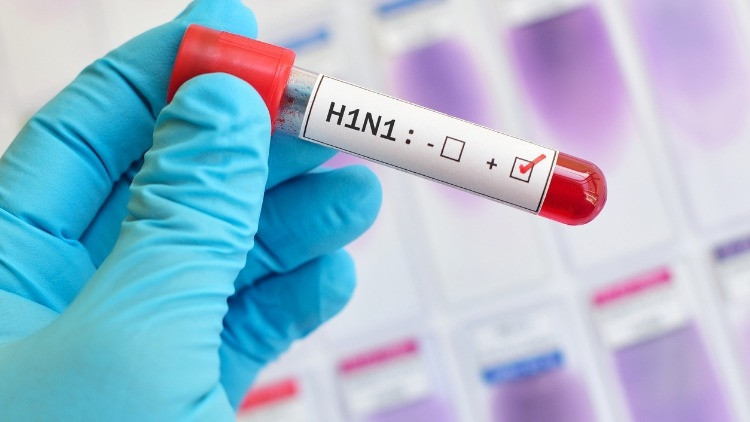H1N1 VİRÜSÜ BELİRTİLERİ NELER