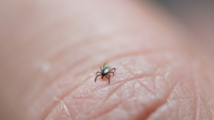 Lyme hastalığı belirtileri nelerdir Lyme hastalığı belirtileri nelerdir