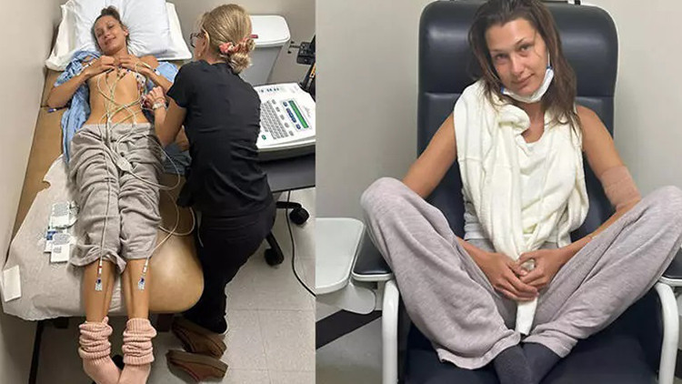 Lyme hastalığı nedir Lyme hastalığı nedir