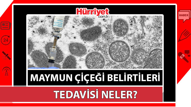 Maymun çiçeği virüsü nedir, belirtileri nelerdir Maymun çiçeği nasıl bulaşır Uzmanlardan uyarı Maymun çiçeği virüsü nedir, belirtileri nelerdir Maymun çiçeği nasıl bulaşır Uzmanlardan uyarı