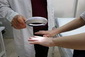 UYUZ BELİRTİLERİ NELERDİR