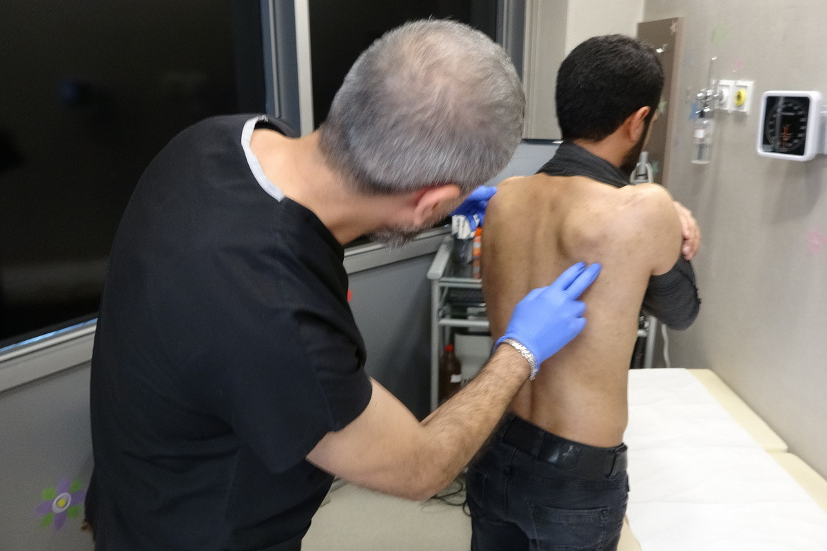 UYUZ TEDAVİSİ NEDİR, NASIL GEÇER