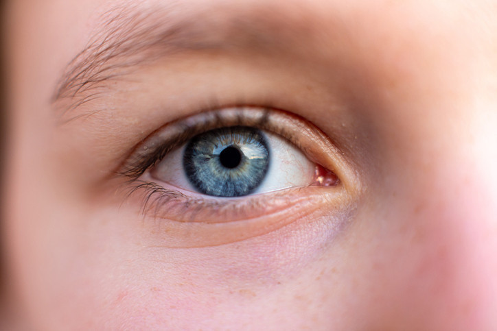 GÖZ ALTI TORBALARINA İYİ GELİYOR