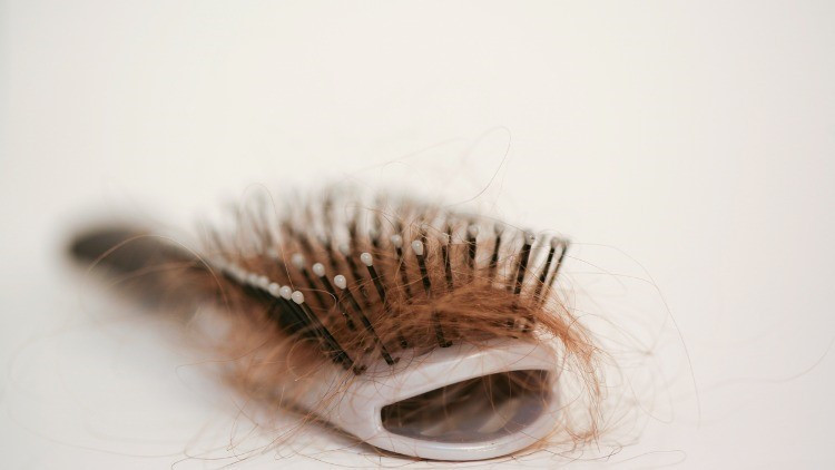 Saçlarınız avuç avuç dökülüyorsa sebebi bu olabilir... Saç fırçanızdaki hastalıklara dikkat