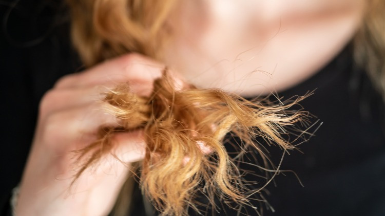 Saçlarınız avuç avuç dökülüyorsa sebebi bu olabilir... Saç fırçanızdaki hastalıklara dikkat