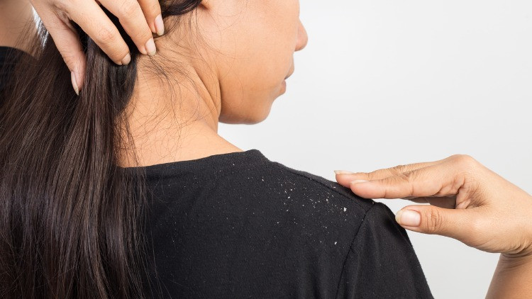 KEPEĞE NEDEN OLABİLİR