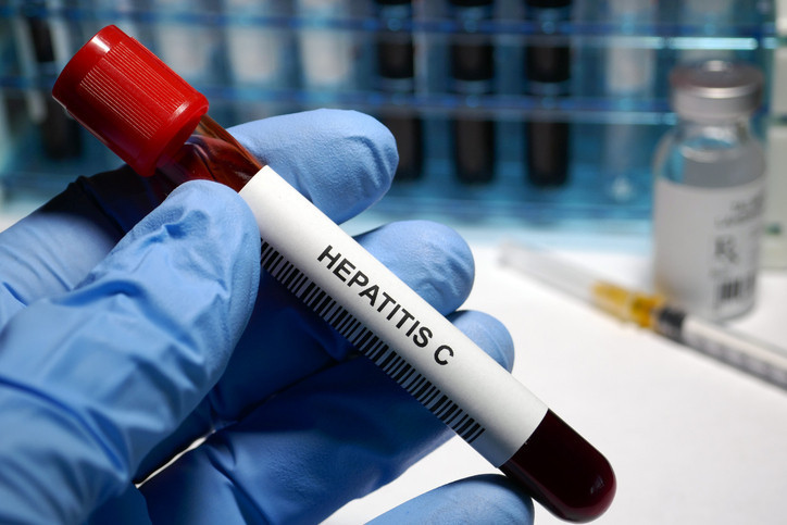 Hepatit C kalpteki hücre ve dokuları etkiliyor