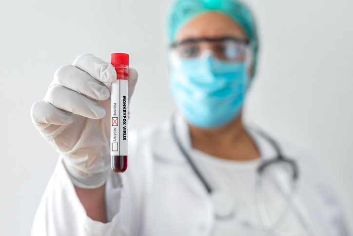 Tanı nasıl konuluyor